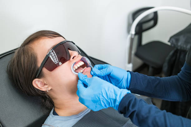 Teeth Whitening in MS
